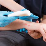 cara mengatasi gigitan ular astra life