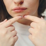 Sejak menggunakan masker menjadi kewajiban, salah satu masalah kulit wajah yang timbul ialah maskne. Begini cara mengatasi maskne.