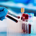 Pandemi-Belum-Usai-Waspada-Varian-Virus-AY-4.2