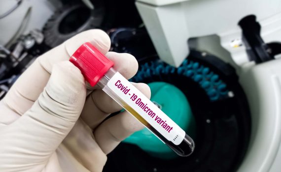 Fakta-yang-Perlu-Kamu-Ketahui-Tentang-Varian-Omicron