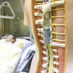 Dari-Kelumpuhan-hingga-Depresi-Inilah-Bahaya-Spinal-Cord-Injury