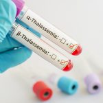 Thalassemia Pertimbangan untuk Batal Menikah Kok Bisa_3